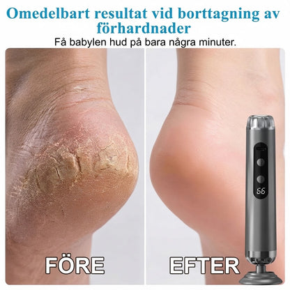 Elektrisk fotfil med 5 hastigheter och 50 slipdynor